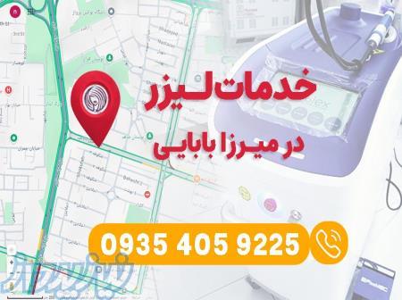 خدمات لیزر در میرزا بابایی 