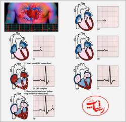 ازمون های نوار قلب  - تهران