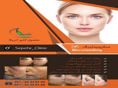 میکرونیدلینگ Microneedling 